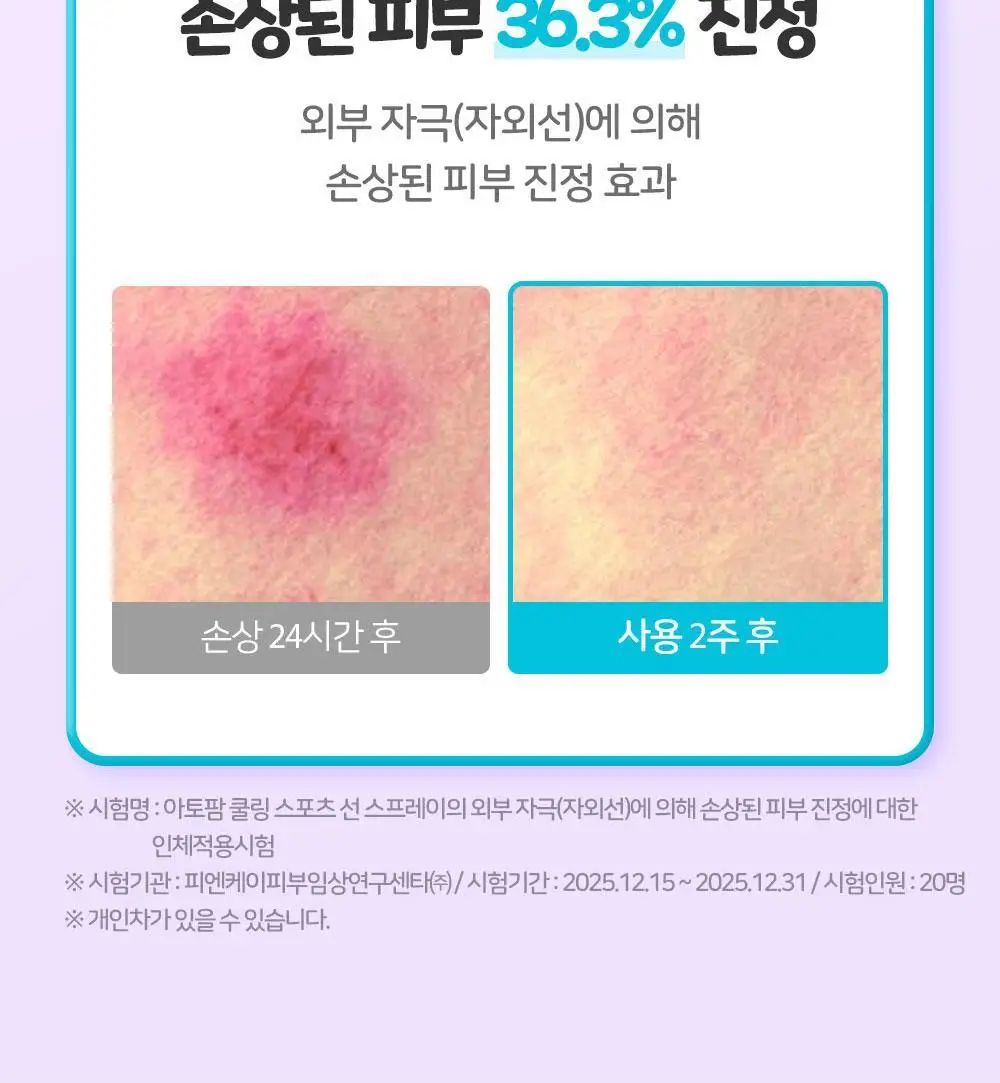 [티니핑 콜라보] 아토팜 쿨링 스포츠 선 스프레이 100ml 상세페이지 38
